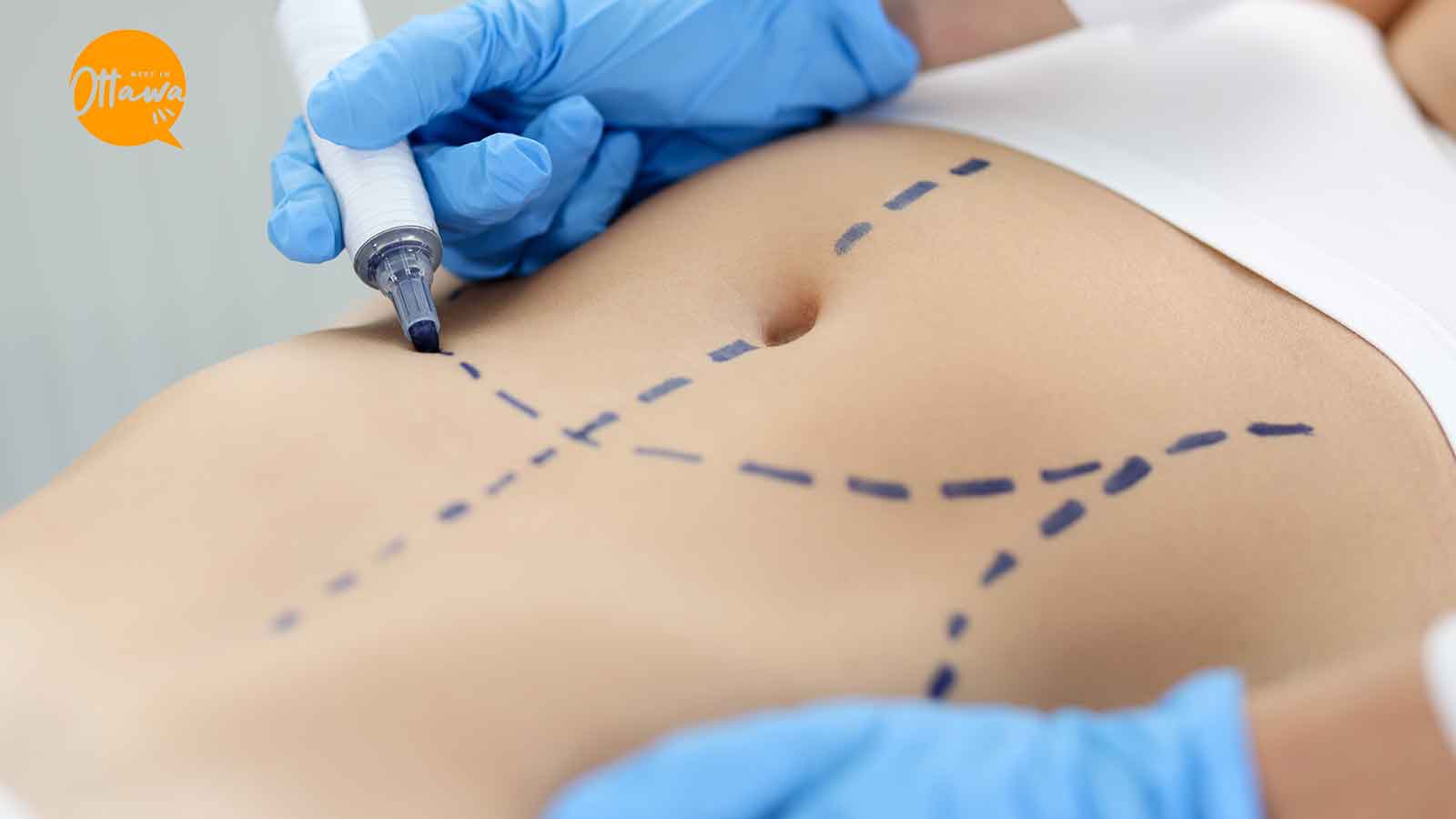 Myths about Cosmetic Surgery Debunked