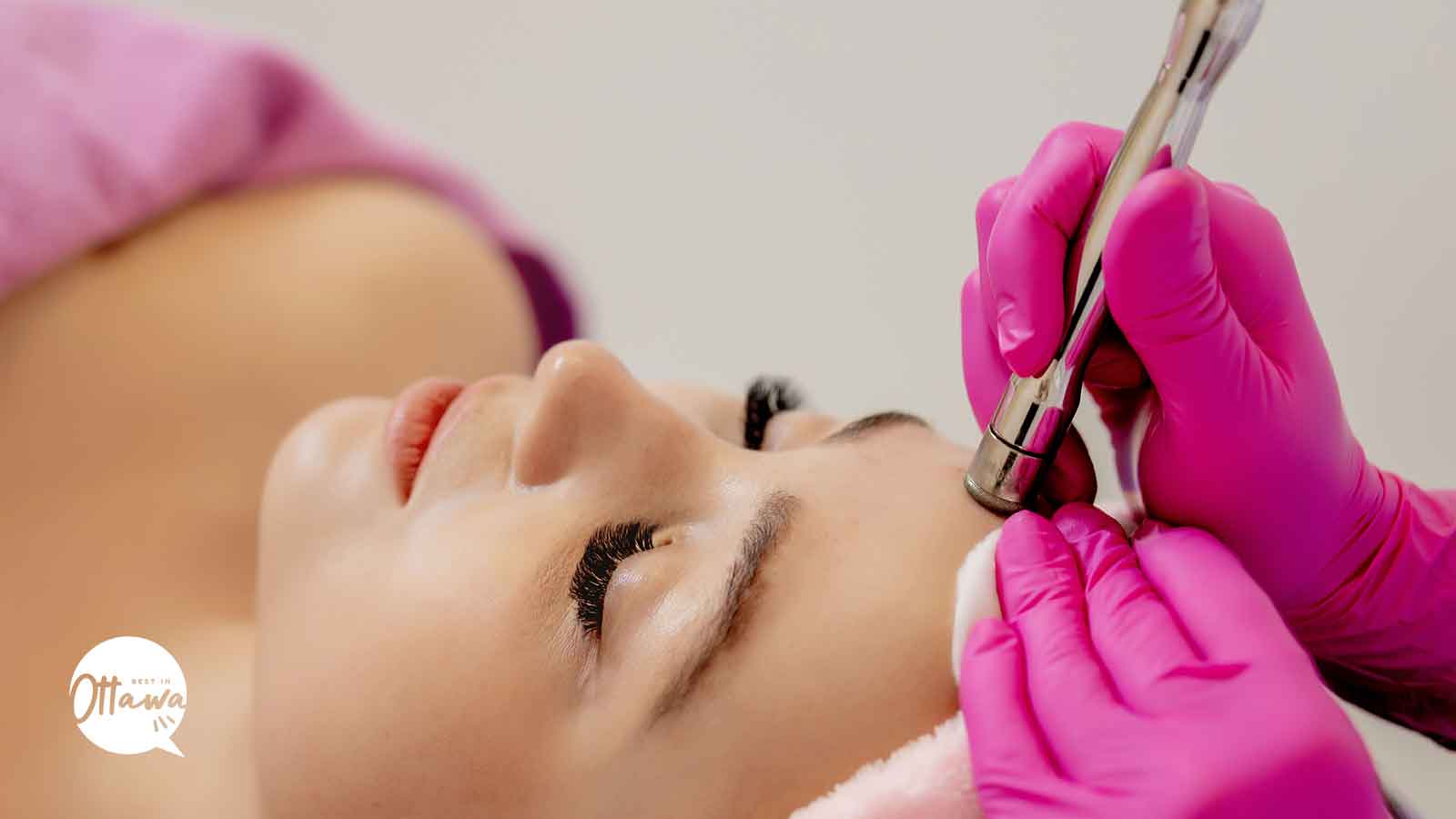 Best Microdermabrasion in Ottawa