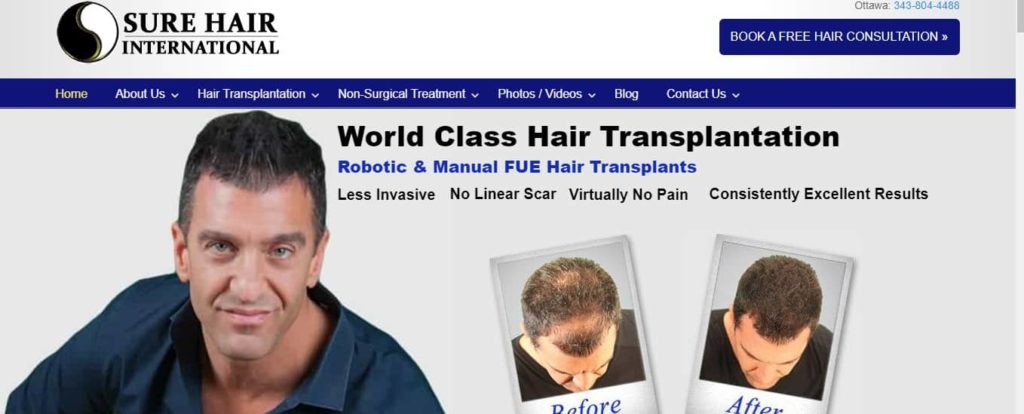 Sure Hair International's homepage