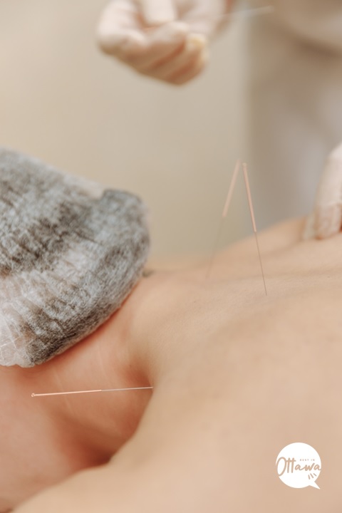 Get a good massage (or try acupuncture)