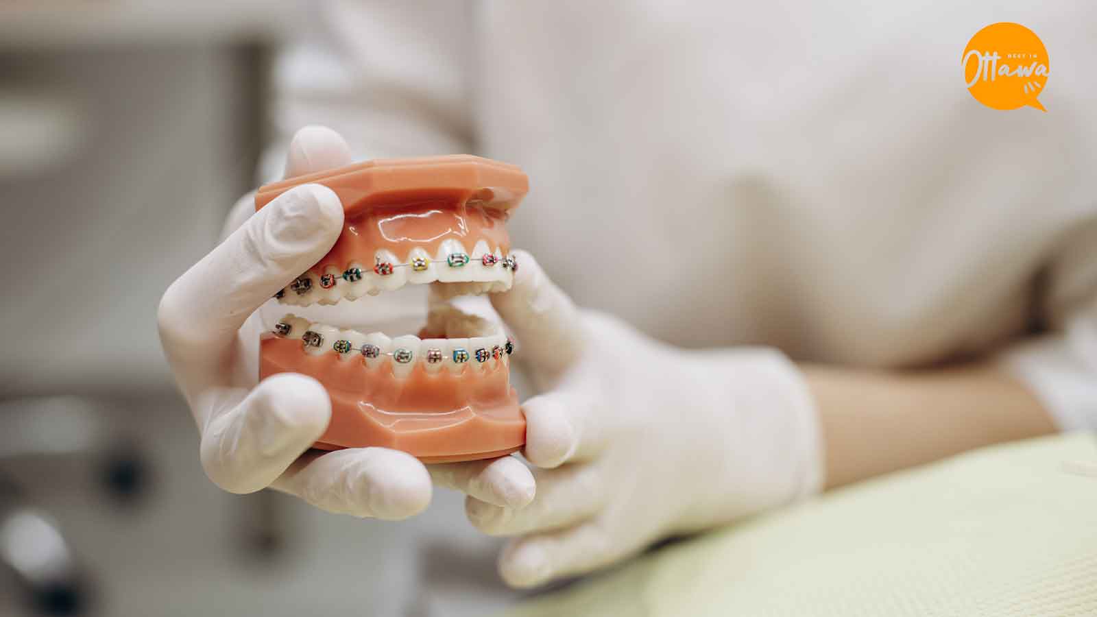 Best Places to Get Ceramic Braces in Ottawa