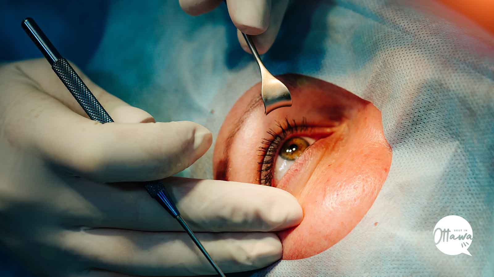 Best Clinics for Ptosis Surgery in Ottawa
