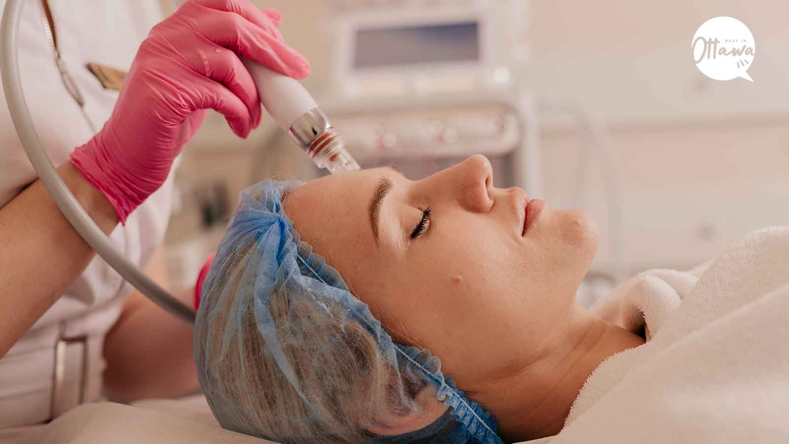 Best Acne Scar Treatment Clinics in Ottawa