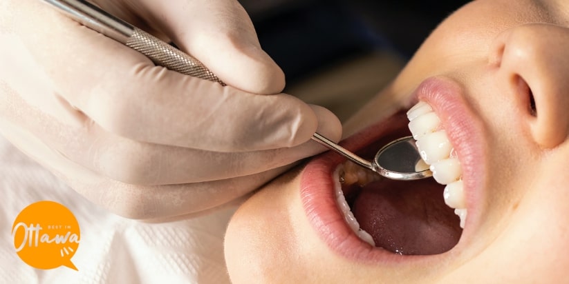 5 Best Clinics for Scaling and Polishing in Ottawa