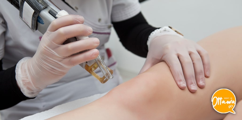 5 Clinics for IPL Services in Ottawa