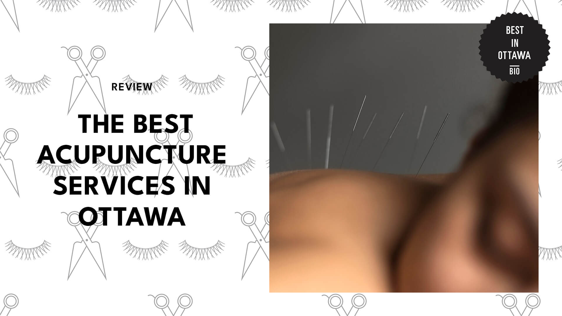 Best Acupuncture